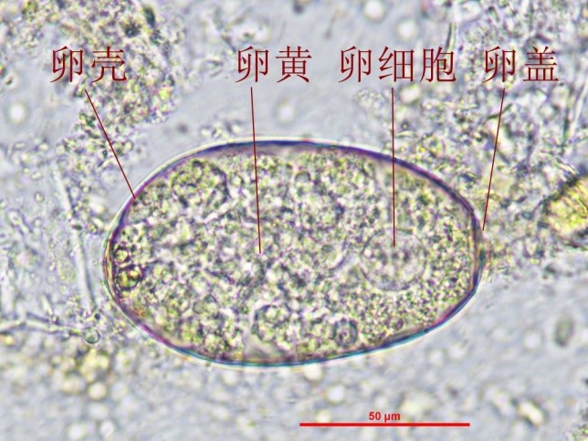 肝吸虫虫卵寄生虫画图图片