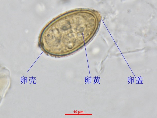 图4:油镜下肝吸虫卵(下)和异形吸虫卵(上)图3:油镜下肝吸虫卵细致结构
