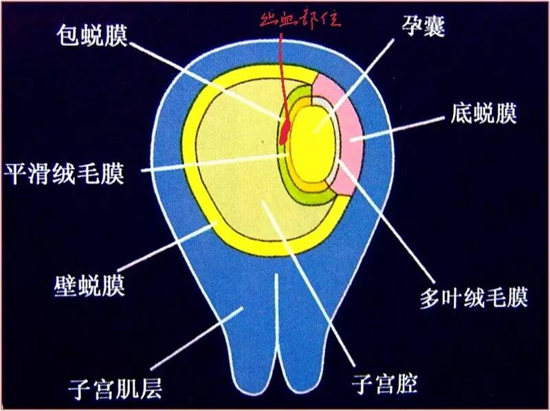胎膜羊膜胎盘的关系图图片