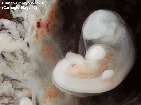 4周时人类胚胎的样子