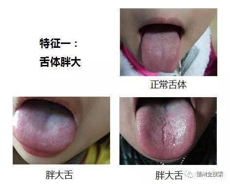 任何咳嗽,不用止咳药,只此一招,便能除根(小孩用好更快)