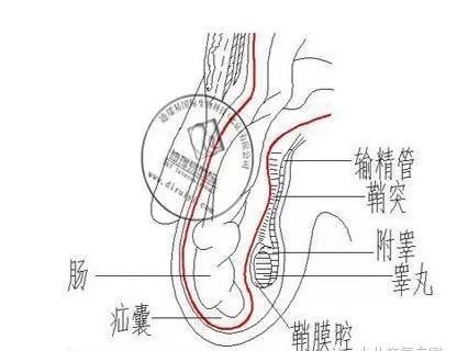 男人小肠疝气症状图片