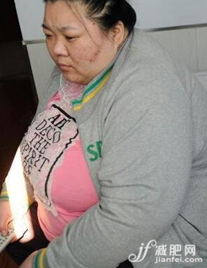 24岁440斤!中国第一胖女开始减肥了!