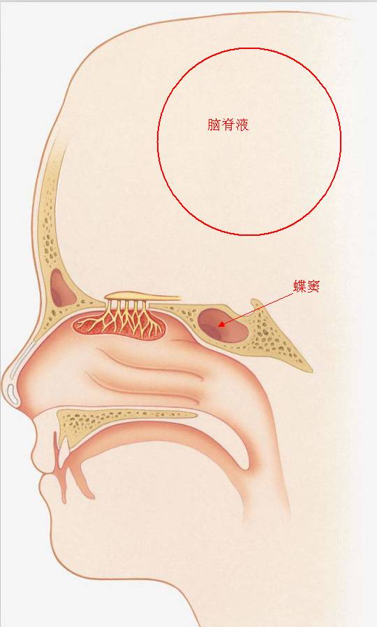 蝶窦位置图片