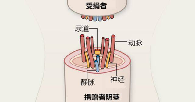 7 个多小时才接上去的世界首根成功异体移植的丁丁