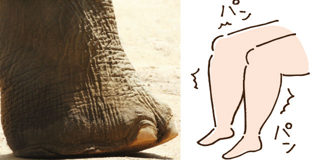 大象腿是什么样子的图片