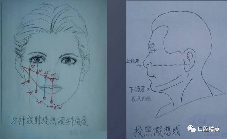 肋骨斜位的投照方法图图片