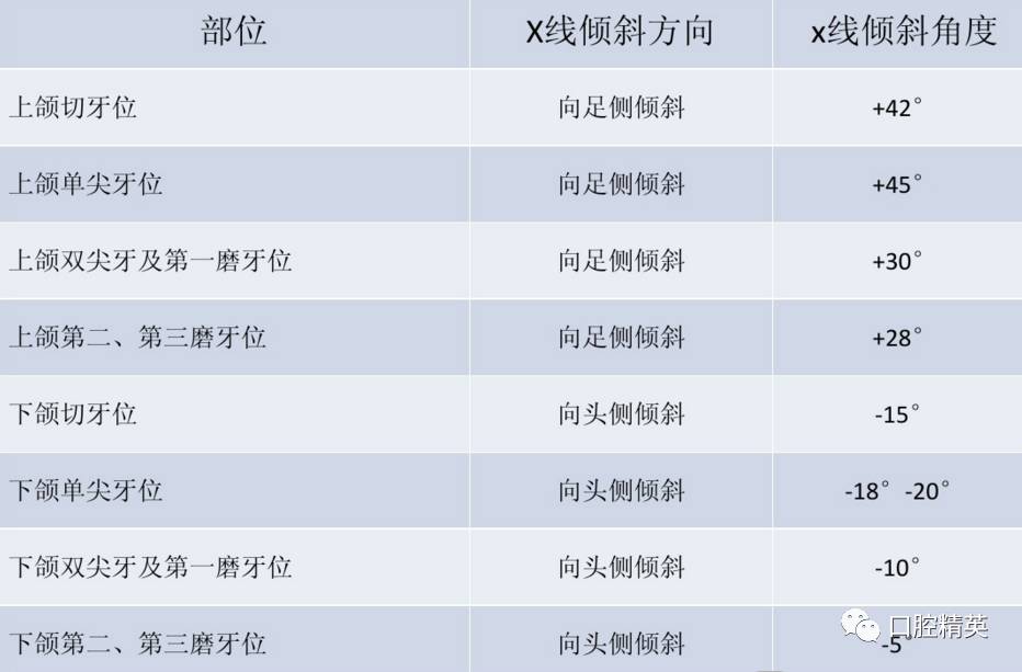 负角度:拍摄投照下颌牙时,x线向头侧倾斜,称为负角度