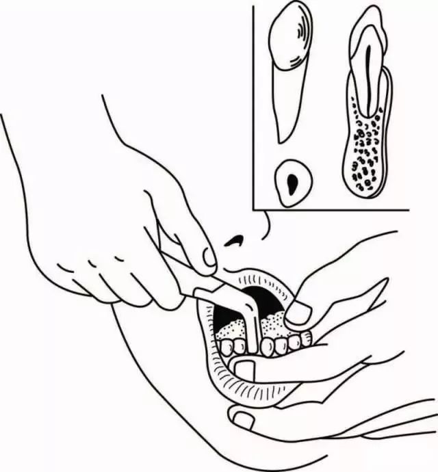 拔牙钳简笔画图片