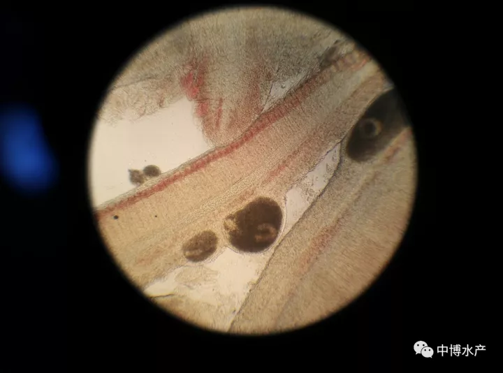 水痘病毒显微镜图片图片