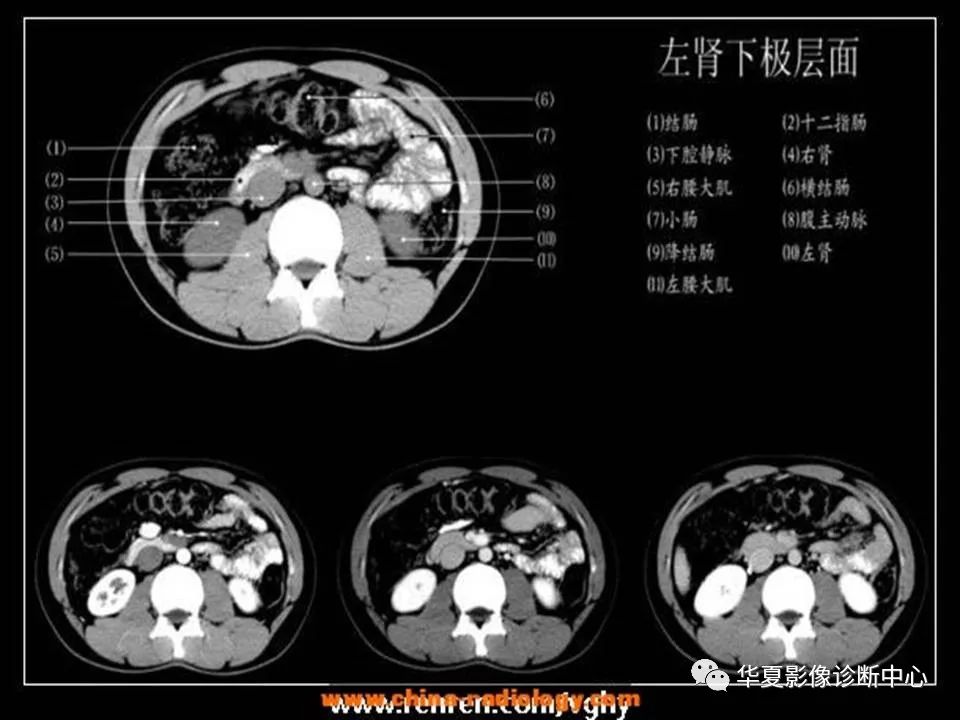 读懂腹部ct解剖只花1小时