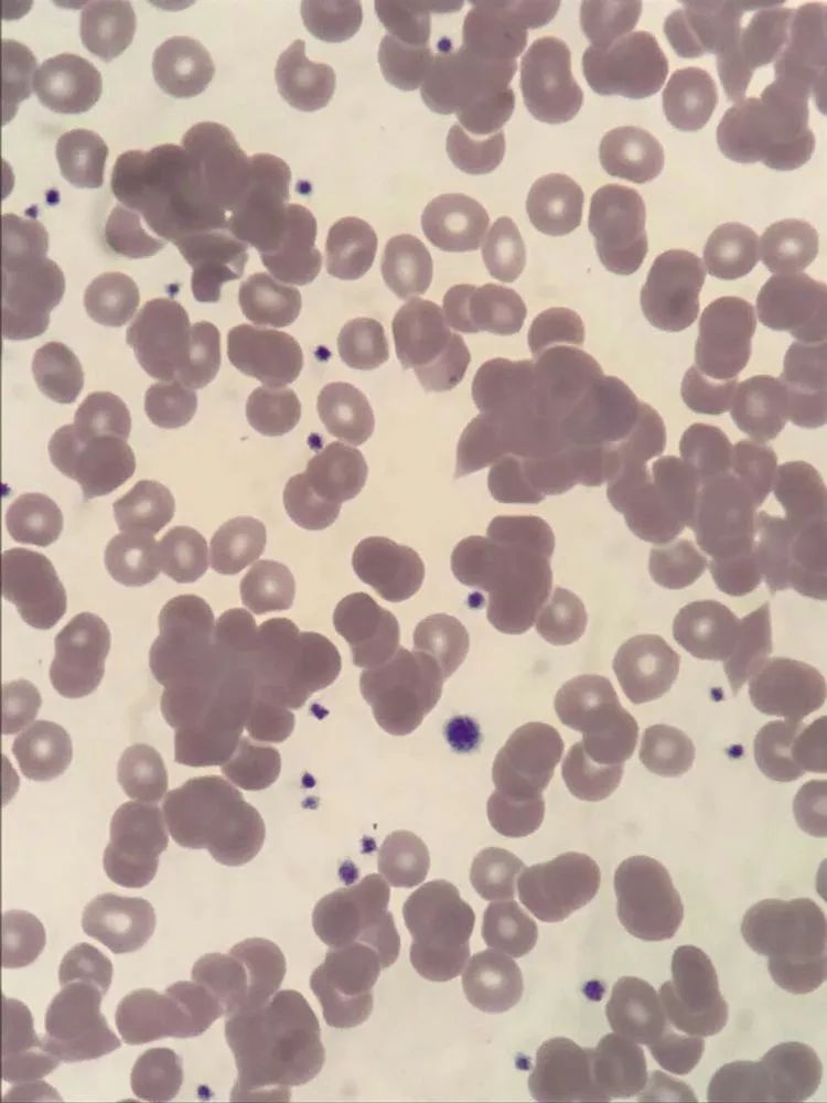 血细胞凝集图图片