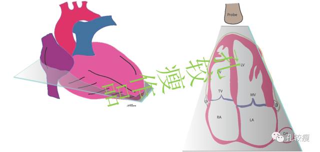 一文讀懂心臟超聲基本切面