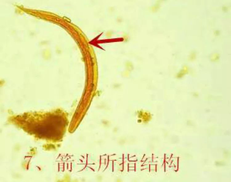 尿道寄生虫图片图片
