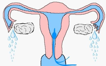 输卵管通水过程图片图片