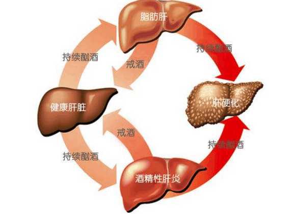 要知道我国是乙肝大国,有8%的人口是乙肝病毒的携带者,1000万以上的