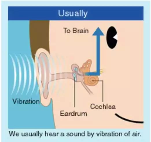 再经听骨链和卵圆窗膜进入耳蜗,这一条声音传导的途径称为气传导(air