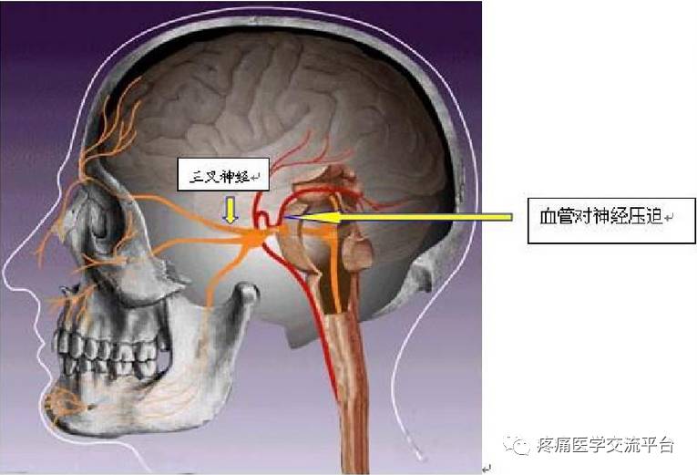 三叉神经解剖及mr表现