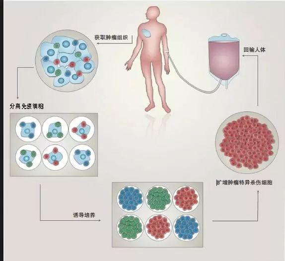 science癌症免疫治療公司解釋cart療法引起死亡事件的原因