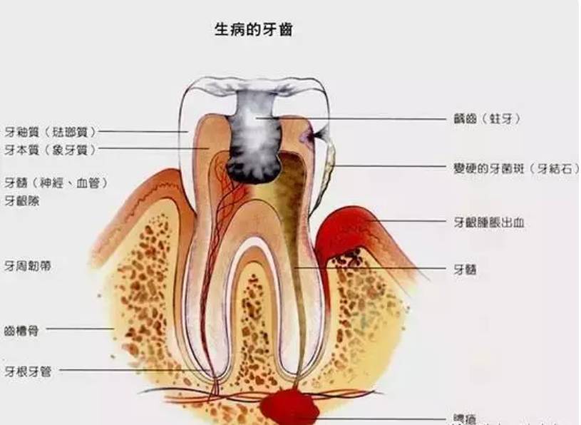牙齿神经解剖图图片