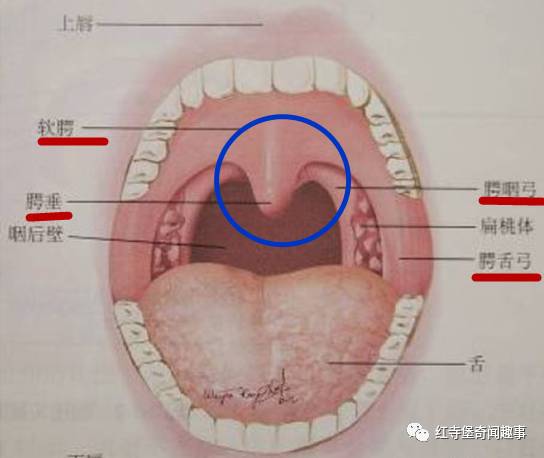 腭垂图片