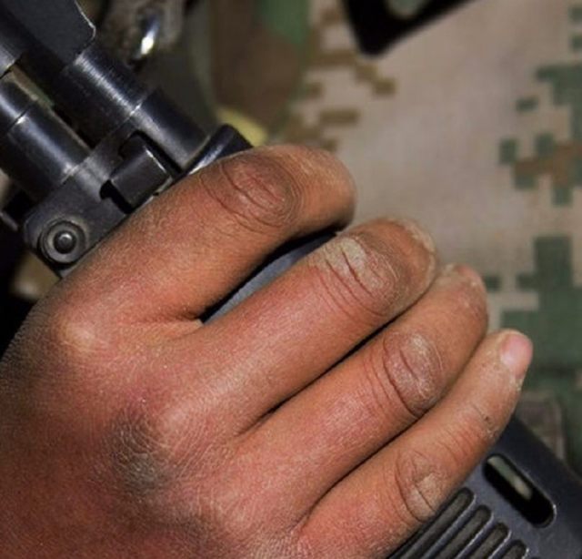 边防战士冻伤的手图片图片