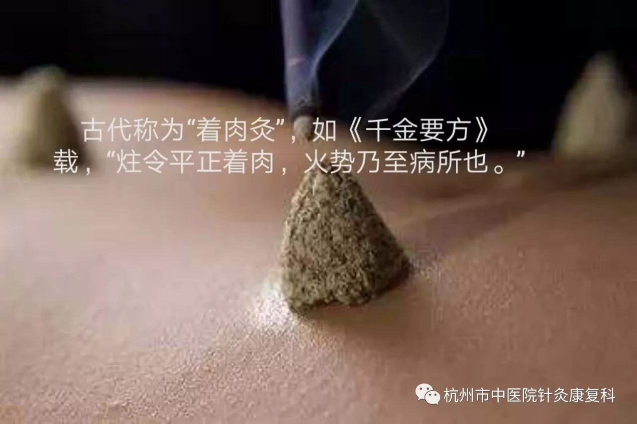 麦粒灸的神奇效果图片