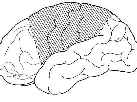 [研究]藥物難治性癲癇大腦半球切除術後腦可塑性的研究進展 | 杜秀玉