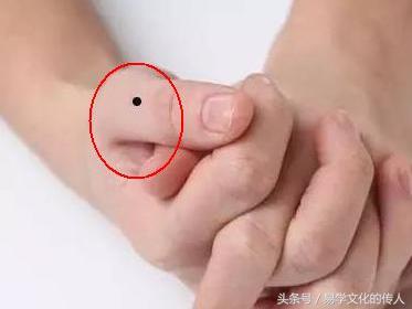 大拇指有痣代表什么图片