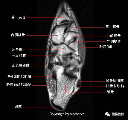 解剖踝關節系統解剖圖冠矢軸mri