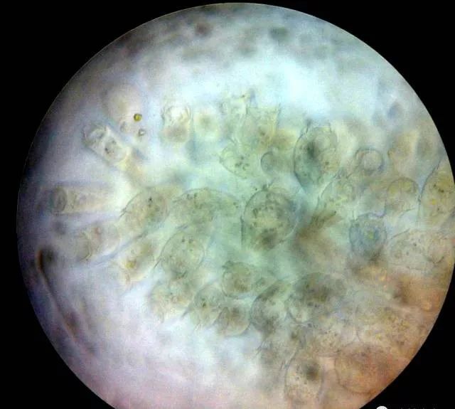 杯体虫显微镜图片图片