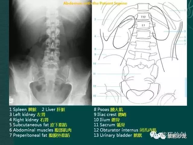 详细腹部平片解剖正常表现读片技巧病例分析