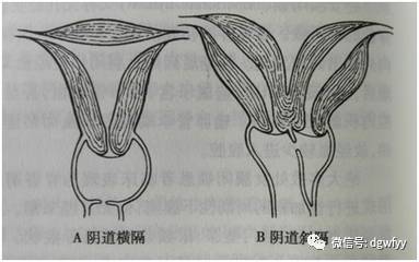 女人小腹疼痛不可大意,及時查明原因對症治療