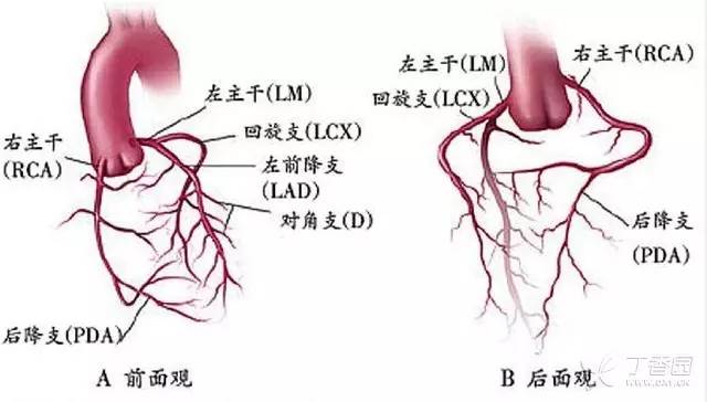 如何看懂冠脉造影图图片