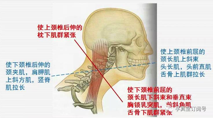 头夹肌和头半棘肌图片