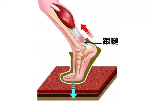 慕樂肌內效貼跟腱炎貼法