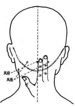 3.风池穴