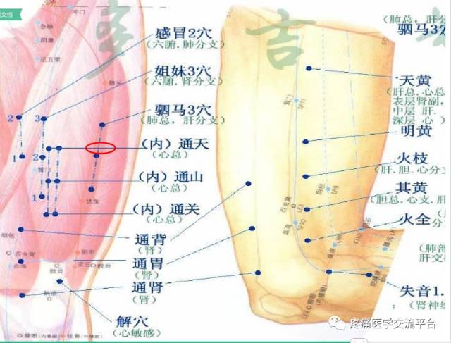 董氏奇穴常用穴位取穴,功效总结