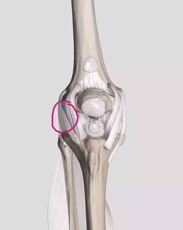 通常外伤可能导致内侧韧带损伤,有过髌骨外脱位可能导致支持带损伤