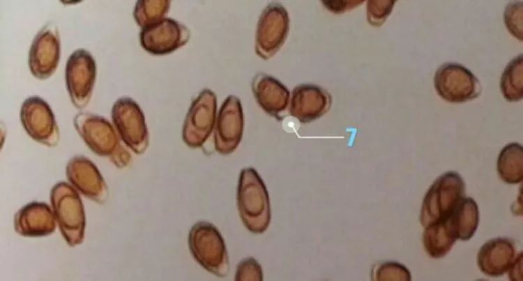 公佈答案:(僅供參與)1鐘形蟲2班氏絲蟲微絲蚴3腎小管上皮細胞管型4