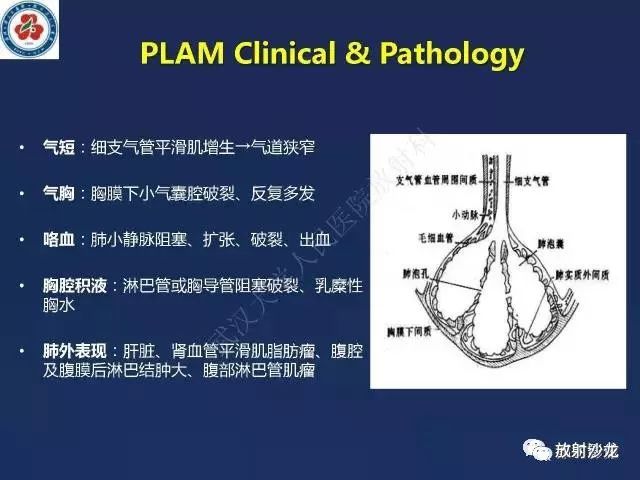 【中放現場專家課程】今晚19:30宋彬《肝臟富血供病變的影像學診斷與