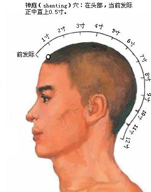 按摩神庭穴50次,迅速緩解頭痛頭暈