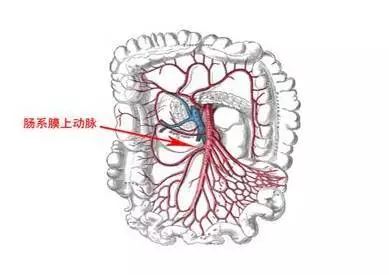 肠系膜动脉栓塞是肠系膜上动脉突然被栓子完全阻塞所致的疾病,本病