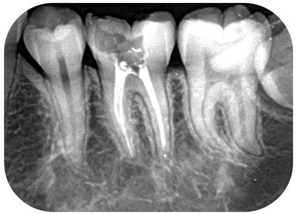 其实,拍牙片是医治进程中的重要手段之一,它能提供普通检查办法所不能