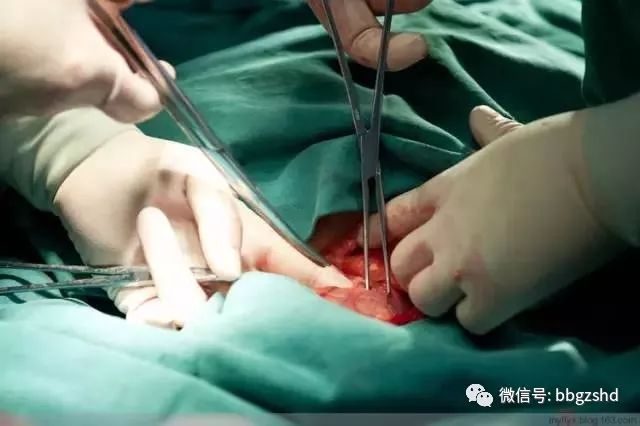 孕妈宝典100张剖腹产过程照片看完才知道生孩子有多不容易