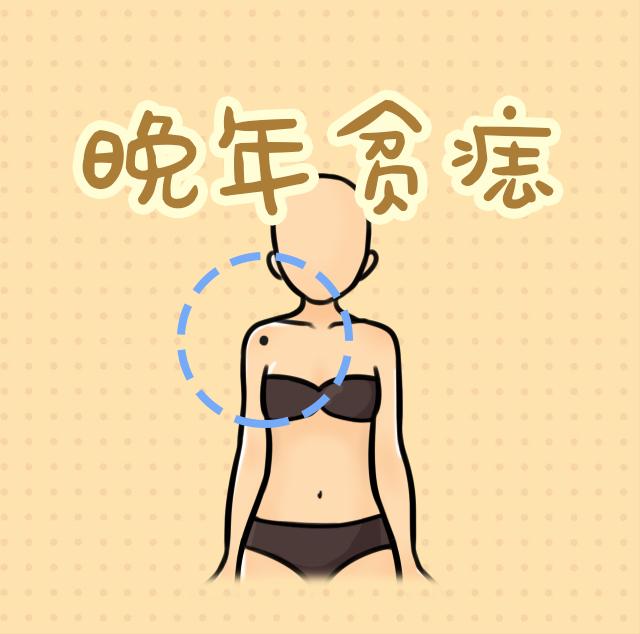 长了狼心狗肺痣的女人图片