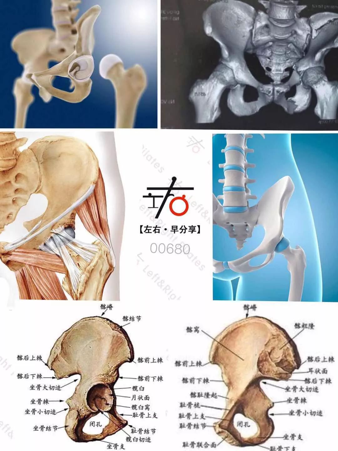 髂骨翼的位置图片图片