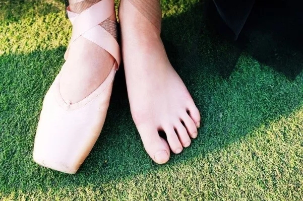 抛开芭蕾舞者的脚, 其实任何一个普通人的脚趾都有可能会变形
