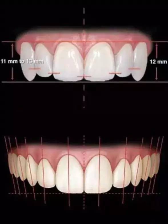 下切牙是哪颗牙图片