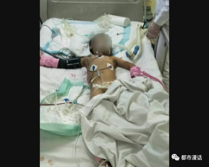 漫话61救助4岁女童车祸重伤医护人员全力抢救